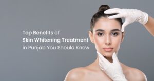 Top Benefits of Skin Whitening Treatment in Punjab You Should Know