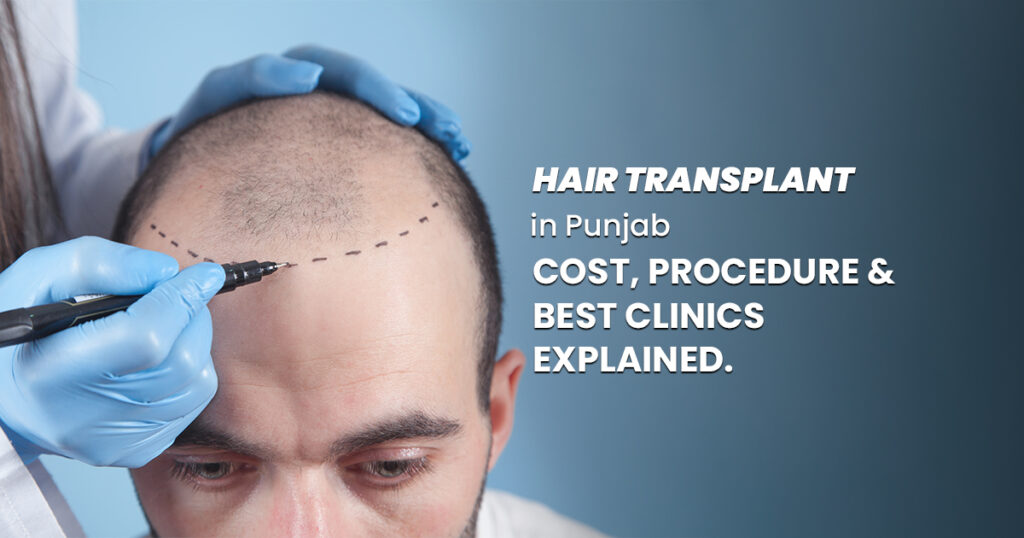 Hair Transplant in Punjab