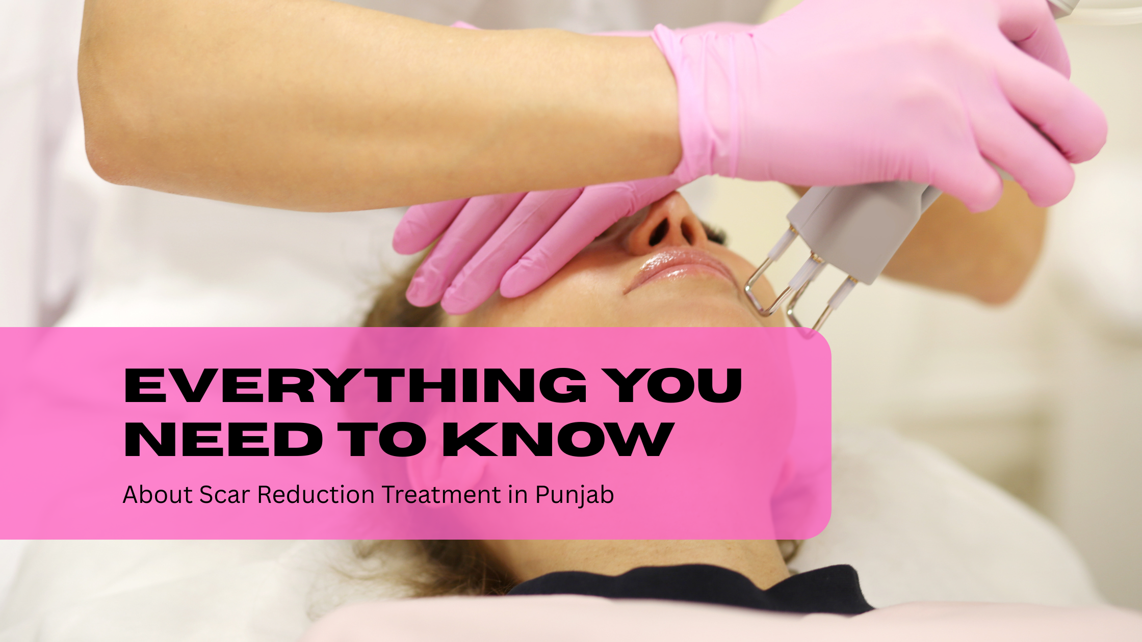 Everything You Need to Know About Scar Reduction Treatment in Punjab